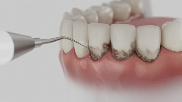 Trusted Dental Implants service in Austin, TX - Dentist Open Now